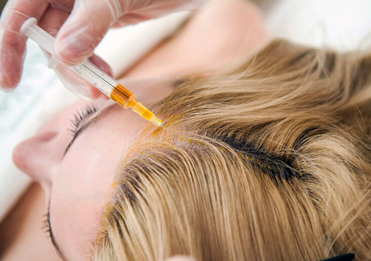 Лечебная терапия применяется при выпадении волос