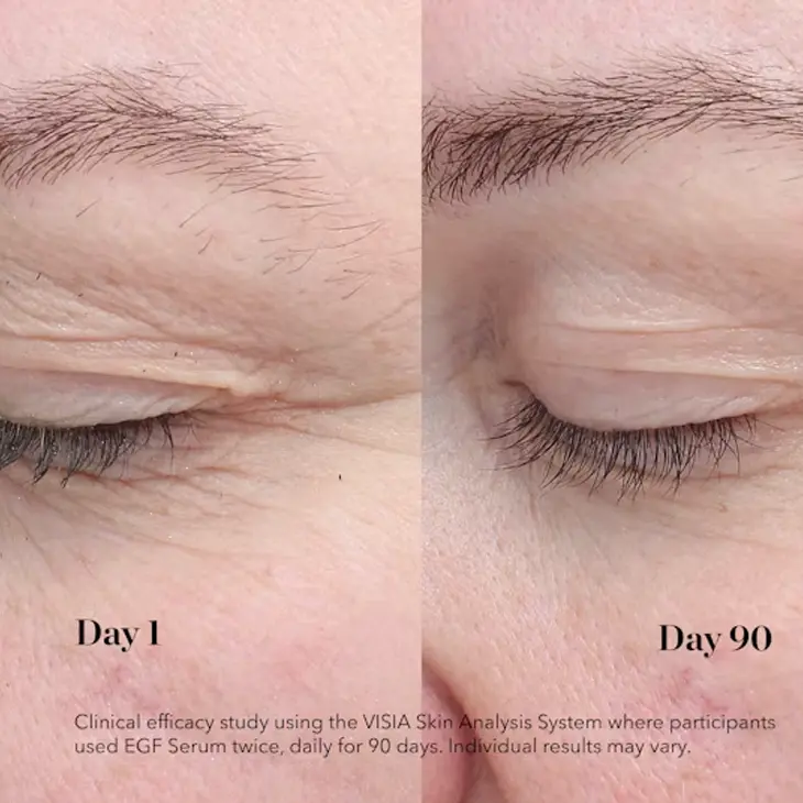 bioeffect egf eye serum