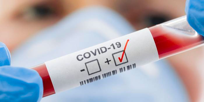 COVID-19