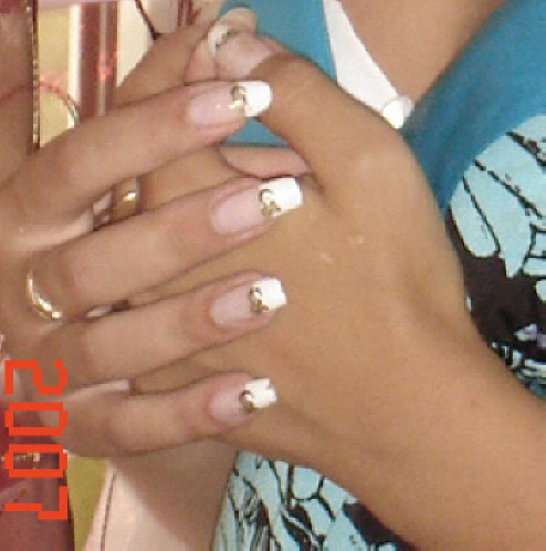 ������������� �����������